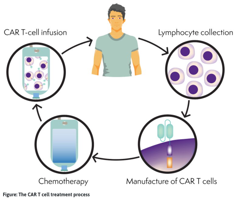 CAR T-šūnu process