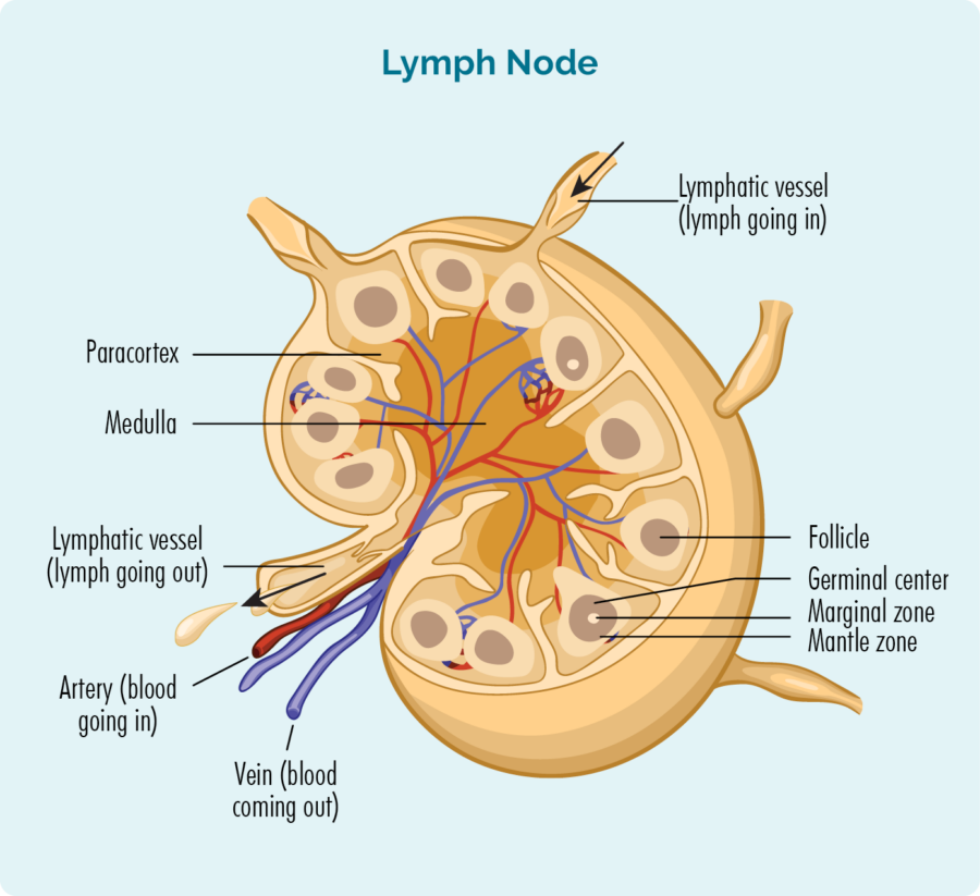 Marginal Zone Lymphoma (MZL) - MALT, Nodal & Splenic - Lymphoma Australia