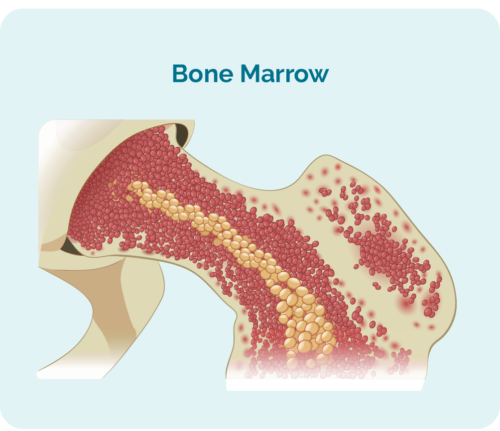 Bone Marrow sample are taken during a bone marrow biopsy