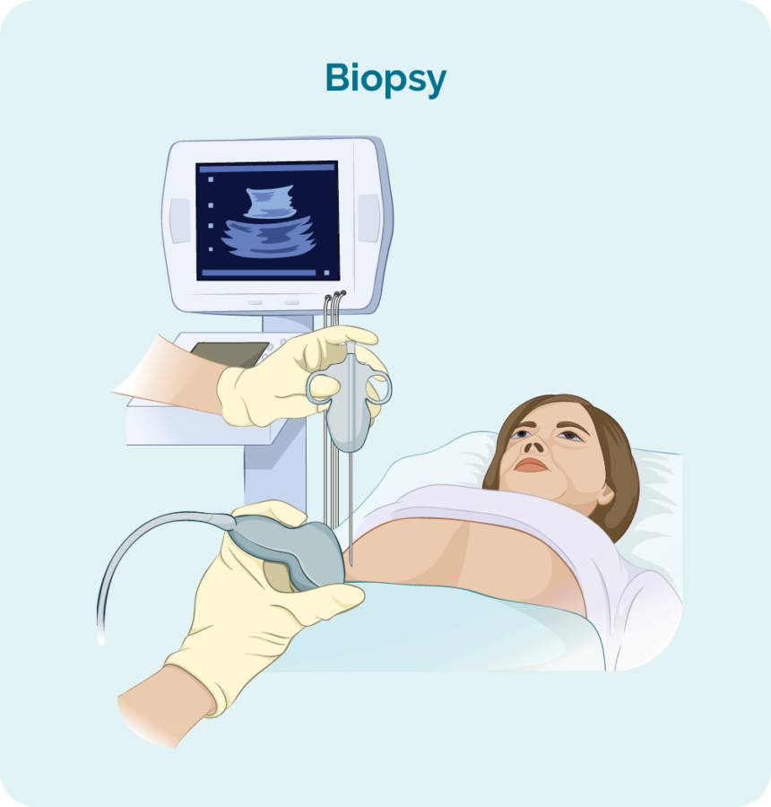 Some biopsies may be done with the help of ultrasound guidance