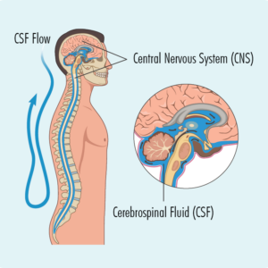 Unha punción lumbar pódese usar para comprobar se hai linfomas no sistema nervioso central ou para administrar quimioterapia ao líquido cefalorraquídeo.