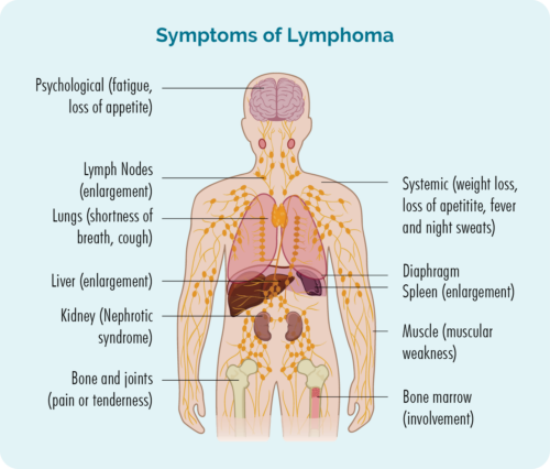 Symptomen fan lymfoom kinne omfetsje wurgens, ferlies fan appetit, gewichtsverlies, koarts en kjeld, koarte azem of hoest, swollen lymfeklieren, lever of milt, pine of tearens yn jo gewrichten en spieren en yn guon gefallen, legere bloedsellen of nierproblemen.