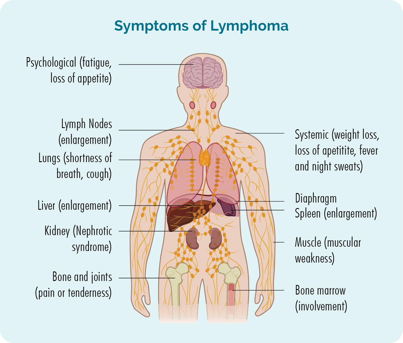 Gejala limfoma dapat meliputi kelelahan, kehilangan nafsu makan, penurunan berat badan, demam dan menggigil, sesak napas atau batuk, pembengkakan kelenjar getah bening, tuas atau limpa, nyeri atau nyeri pada persendian dan otot dan dalam beberapa kasus, penurunan jumlah darah atau masalah ginjal.